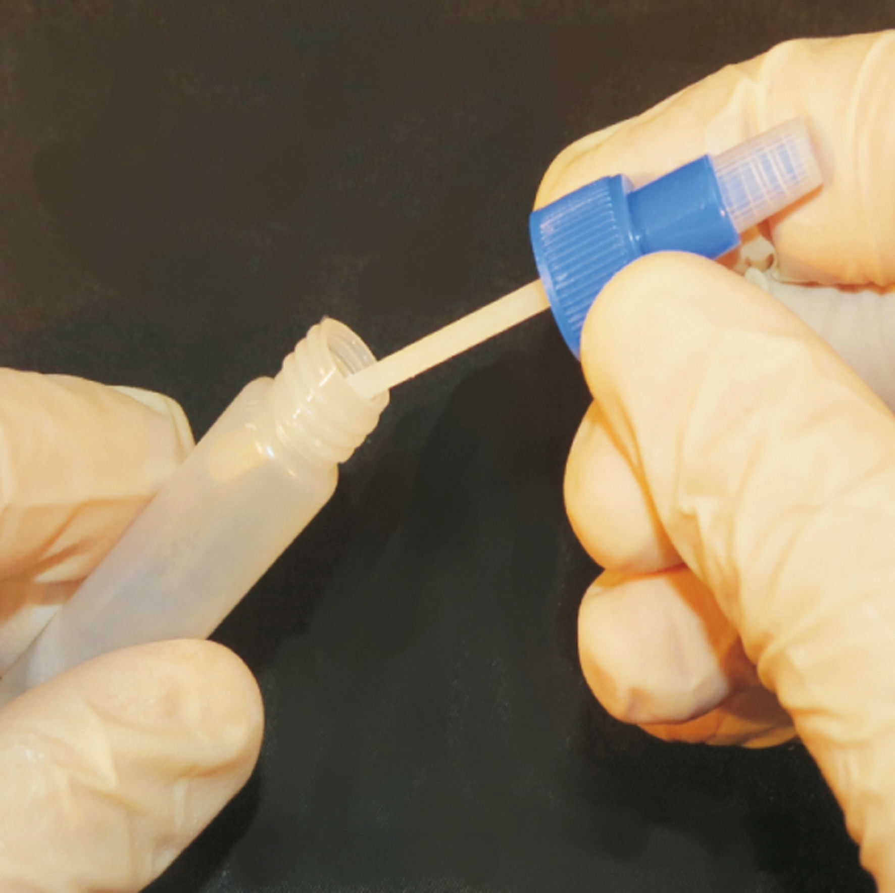 Durchfalltest für Kälber | 5er Pack - Kerbl 15843 Durchfalltest für Kälber | 5er Pack von Kerbl 15843