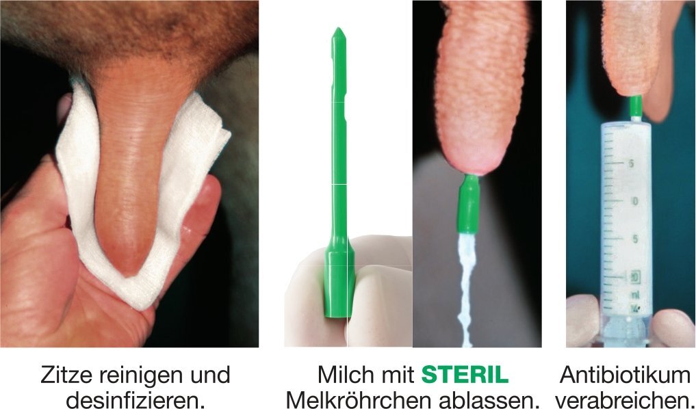 STERIL - Das erste sterile Melkröhrchen | 20er Pack - VUXXX STERIL - Das erste sterile Melkröhrchen | 20er Pack von VUXXX